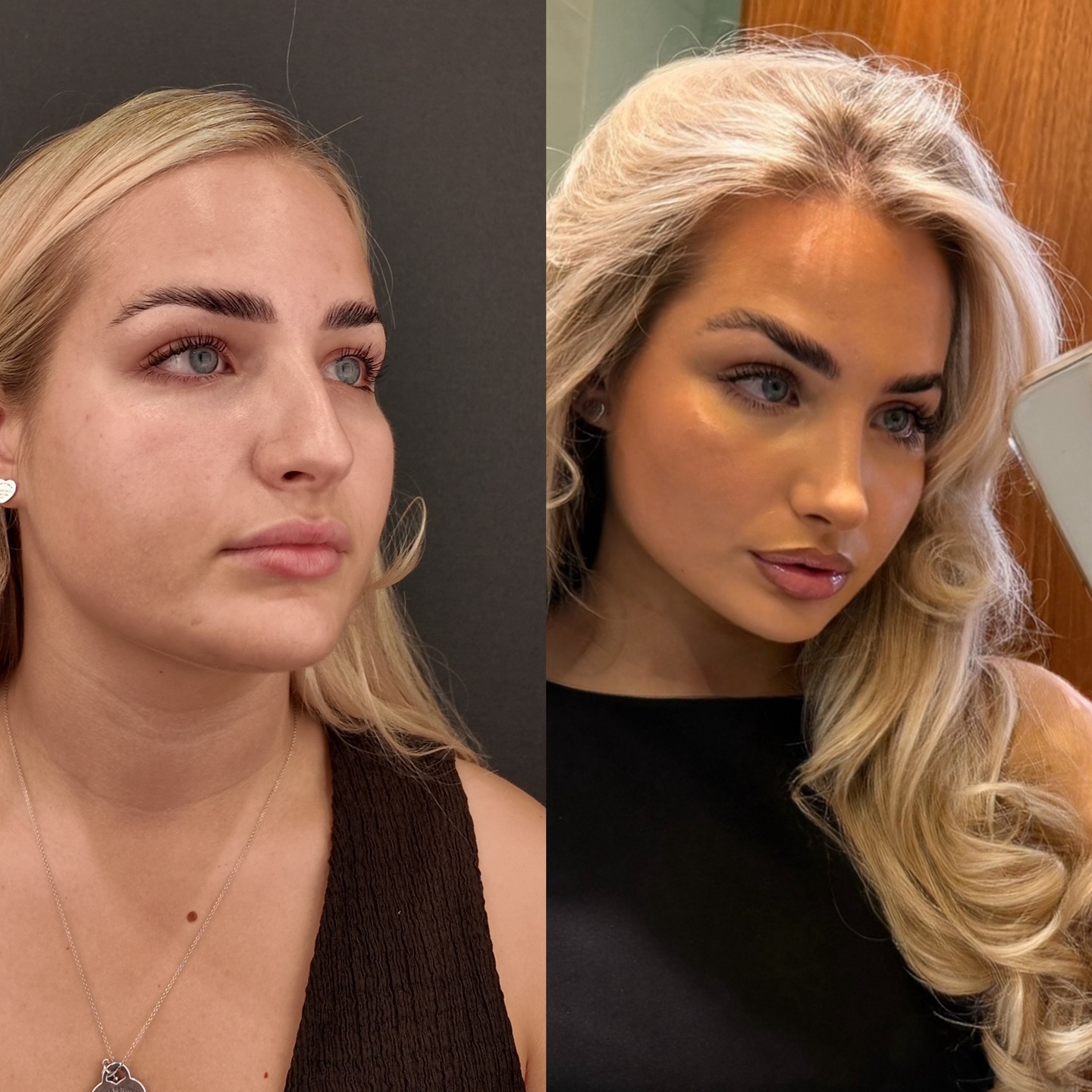 Instagram gönderisi